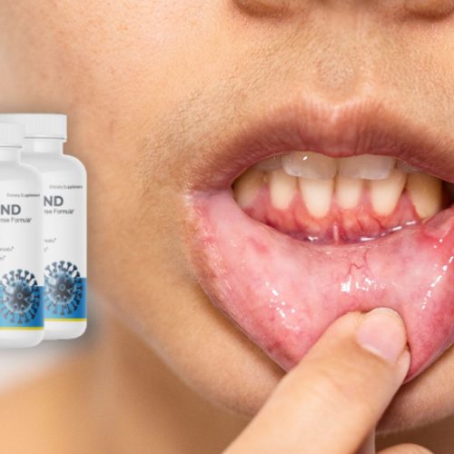 Top 7 Natural Ingredients for Cold Sore Prevention and How Herpafend Utilizes Them